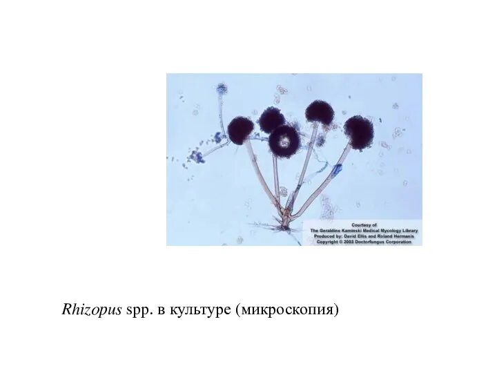 Rhizopus spp. в культуре (микроскопия)