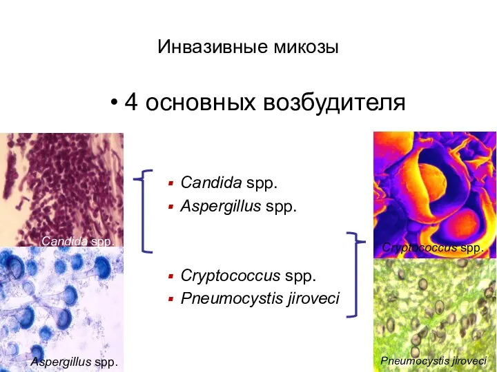 Инвазивные микозы 4 основных возбудителя Candida spp. Aspergillus spp. Cryptococcus spp.