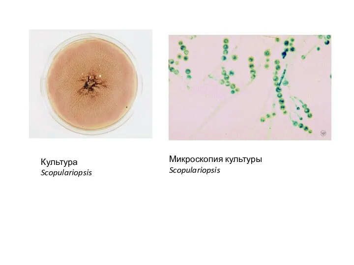 Культура Scopulariopsis. Культура Scopulariopsis Микроскопия культуры Scopulariopsis