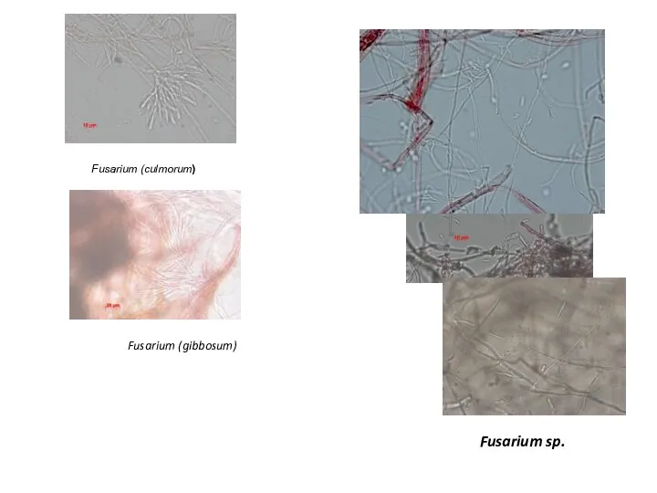 Fusarium sp. Fusarium (culmorum) Fusarium (gibbosum)