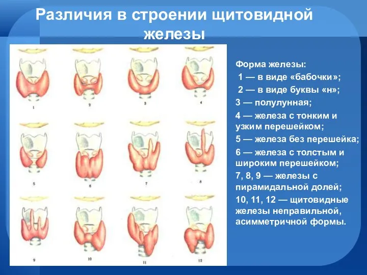 Различия в строении щитовидной железы Форма железы: 1 — в виде