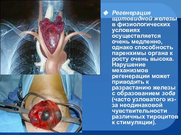 Регенерация щитовидной железы в физиологических условиях осуществляется очень медленно, однако способность