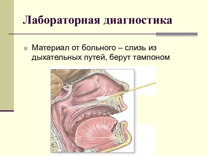 Лабораторная диагностика Материал от больного – слизь из дыхательных путей, берут тампоном