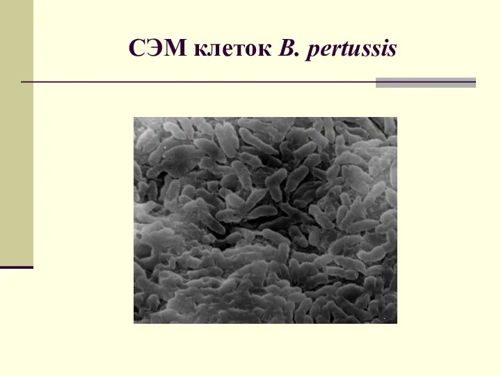 СЭМ клеток B. pertussis