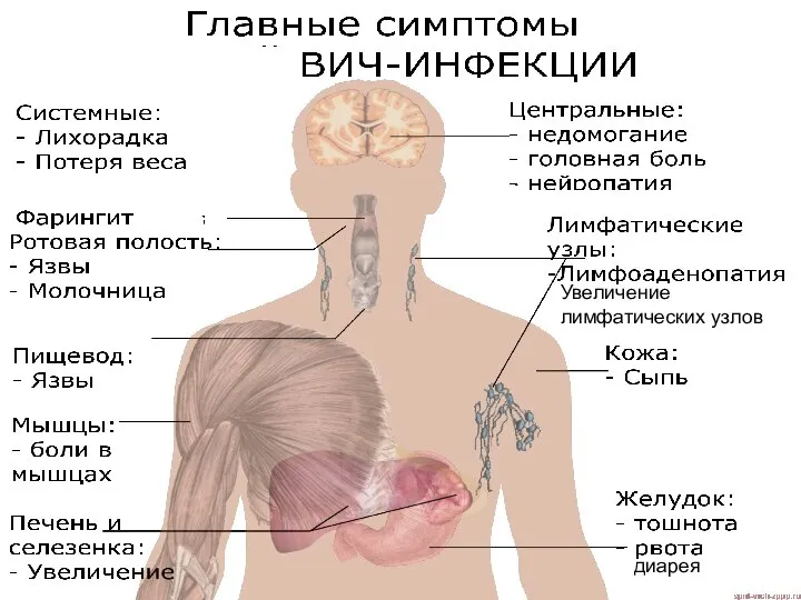 диарея Увеличение лимфатических узлов