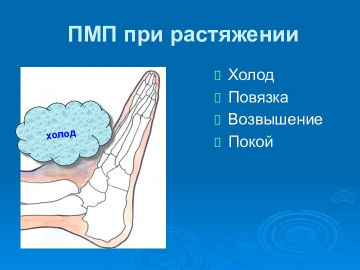 ПМП при растяжении Холод Повязка Возвышение Покой