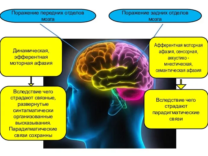 Афферентная моторная афазия, сенсорная, аккустико - мнестическая, семантическая афазия Динамическая, эфферентная