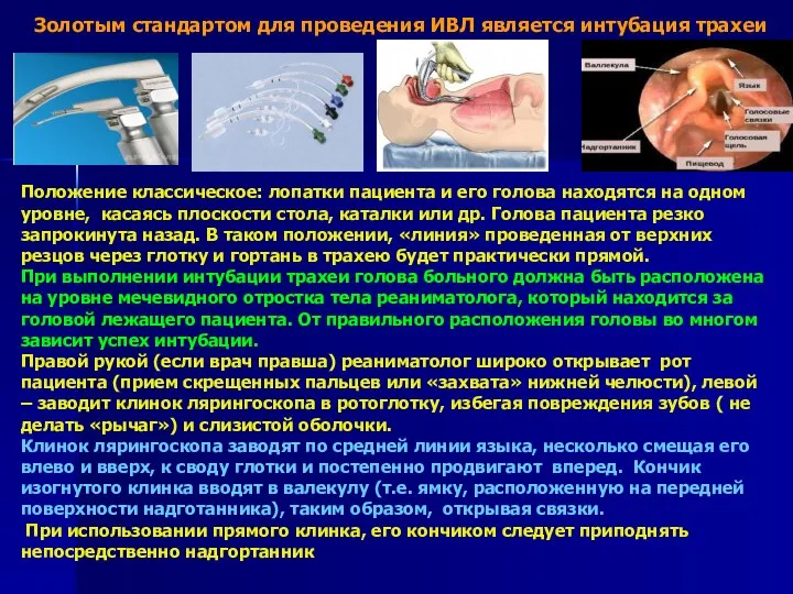 Золотым стандартом для проведения ИВЛ является интубация трахеи Положение классическое: лопатки