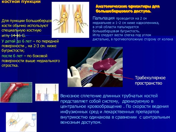 Оборудование для костной пункции Для пункции большеберцовой кости обычно используют специальную