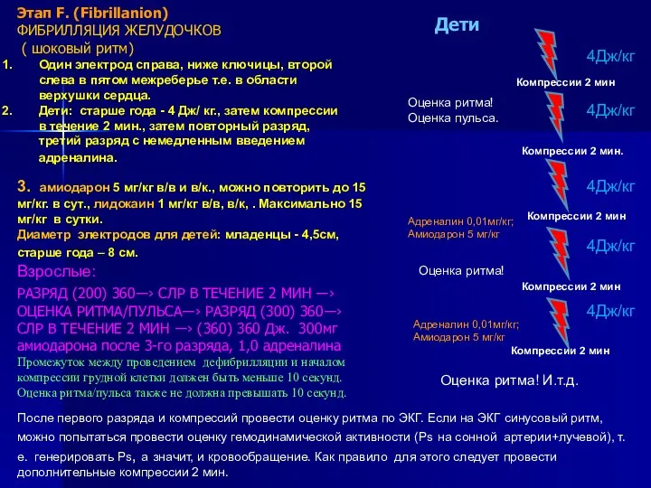 Этап F. (Fibrillanion) ФИБРИЛЛЯЦИЯ ЖЕЛУДОЧКОВ ( шоковый ритм) Один электрод справа,