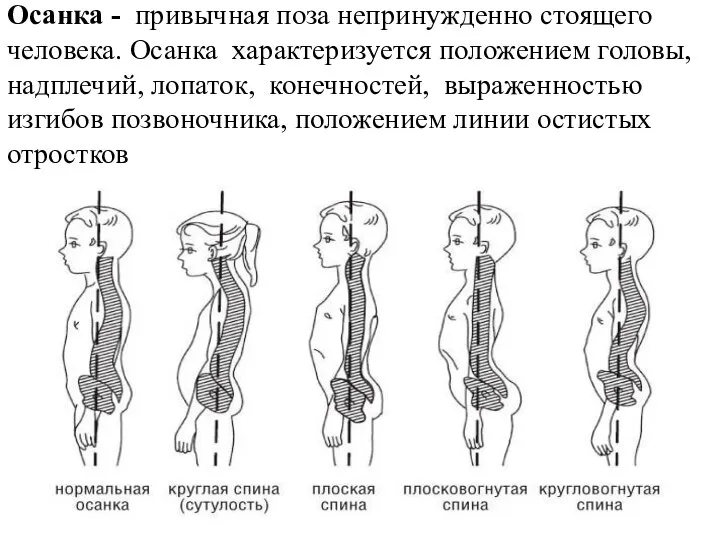 Осанка - привычная поза непринужденно стоящего человека. Осанка характеризуется положением головы,