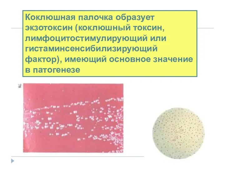 Этиология Коклюшная палочка образует экзотоксин (коклюшный токсин, лимфоцитостимулирующий или гистаминсенсибилизирующий фактор), имеющий основное значение в патогенезе