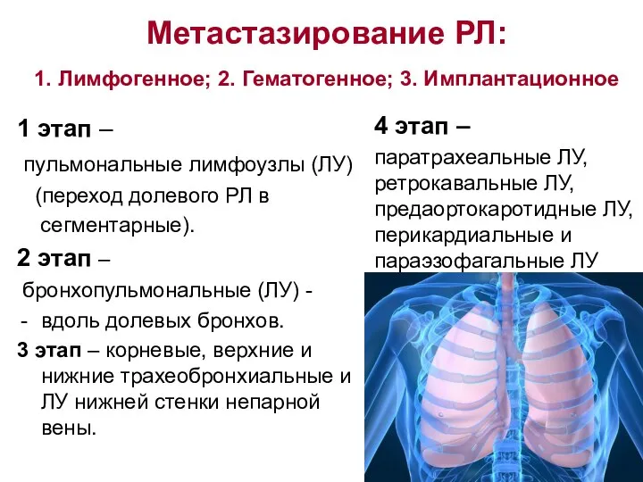 Метастазирование РЛ: 1. Лимфогенное; 2. Гематогенное; 3. Имплантационное 1 этап –