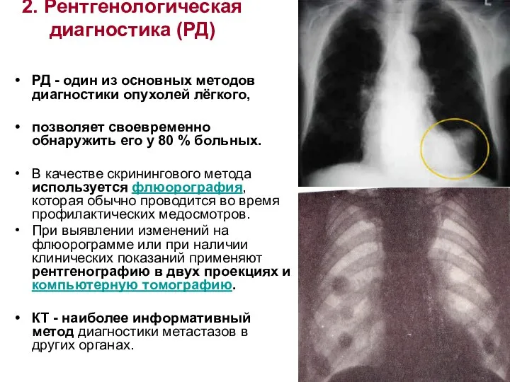 2. Рентгенологическая диагностика (РД) РД - один из основных методов диагностики