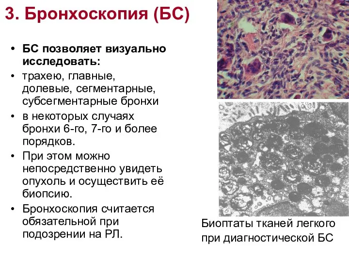 3. Бронхоскопия (БС) БС позволяет визуально исследовать: трахею, главные, долевые, сегментарные,