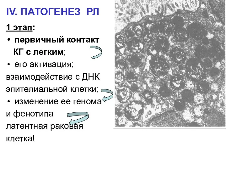 IV. ПАТОГЕНЕЗ РЛ 1 этап: первичный контакт КГ с легким; его