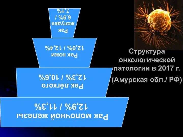 Структура онкологической патологии в 2017 г. (Амурская обл./ РФ)