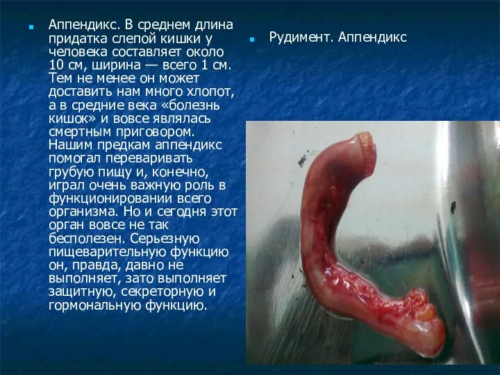 Аппендикс. В среднем длина придатка слепой кишки у человека составляет около