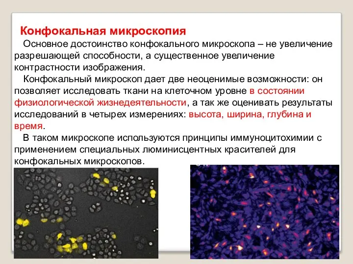 Конфокальная микроскопия Основное достоинство конфокального микроскопа – не увеличение разрешающей способности,