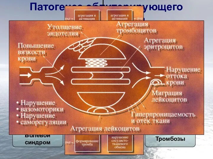 Патогенез облитерирующего атеросклероза