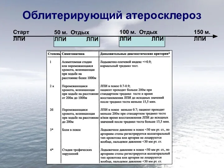 Облитерирующий атеросклероз