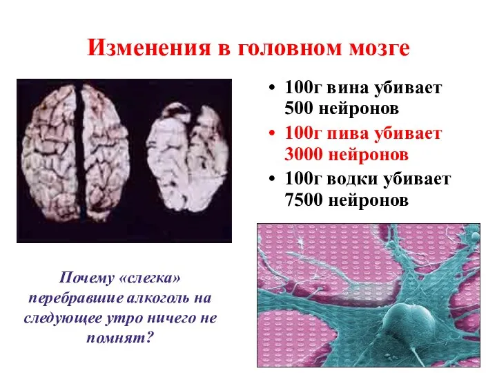 Изменения в головном мозге 100г вина убивает 500 нейронов 100г пива