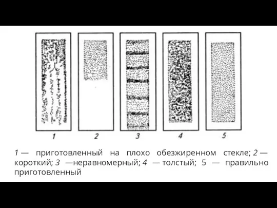 1 — приготовленный на плохо обезжиренном стекле; 2 — короткий; 3