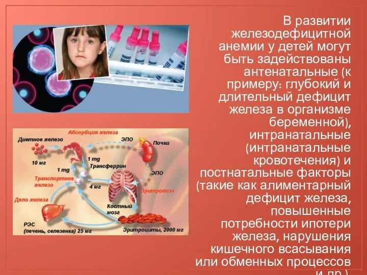 В развитии железодефицитной анемии у детей могут быть задействованы антенатальные (к