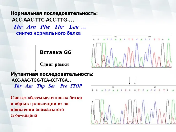 Нормальная последовательность: ACC-AAC-TTC-ACC-TTG-… Thr Asn Phe Thr Leu … синтез нормального