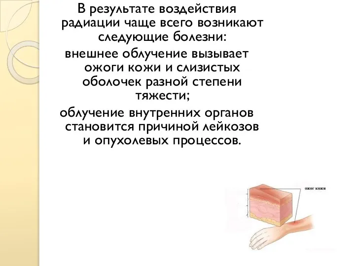 В результате воздействия радиации чаще всего возникают следующие болезни: внешнее облучение