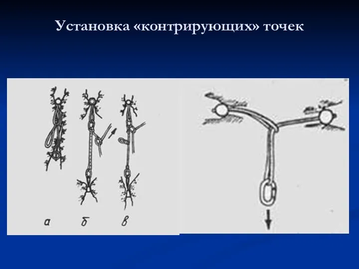 Установка «контрирующих» точек