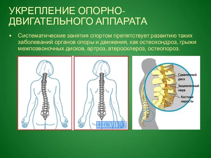 УКРЕПЛЕНИЕ ОПОРНО-ДВИГАТЕЛЬНОГО АППАРАТА Систематические занятия спортом препятствует развитию таких заболеваний органов