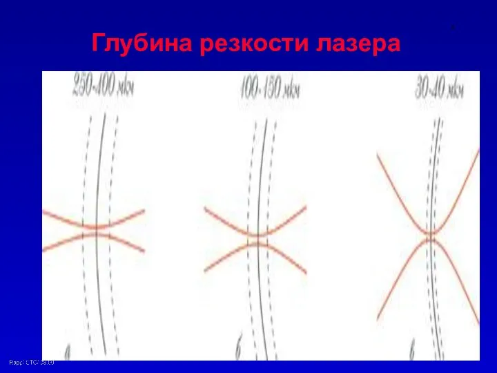 Глубина резкости лазера