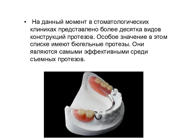 На данный момент в стоматологических клиниках представлено более десятка видов конструкций