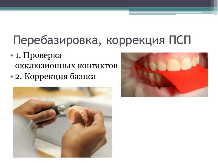 Перебазировка, коррекция ПСП 1. Проверка окклюзионных контактов 2. Коррекция базиса