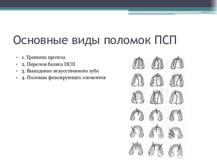 Основные виды поломок ПСП 1. Трещина протеза 2. Перелом базиса ПСП