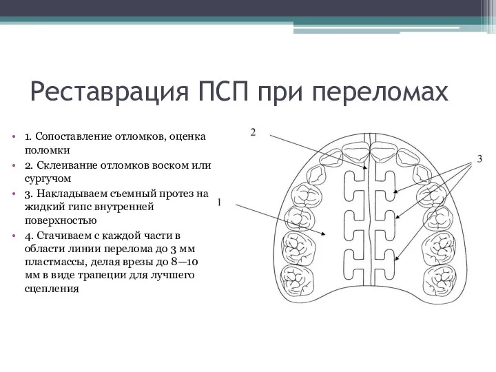 Реставрация ПСП при переломах 1. Сопоставление отломков, оценка поломки 2. Склеивание