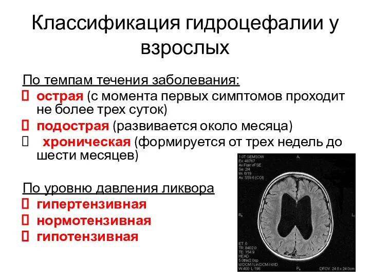 Классификация гидроцефалии у взрослых По темпам течения заболевания: острая (с момента