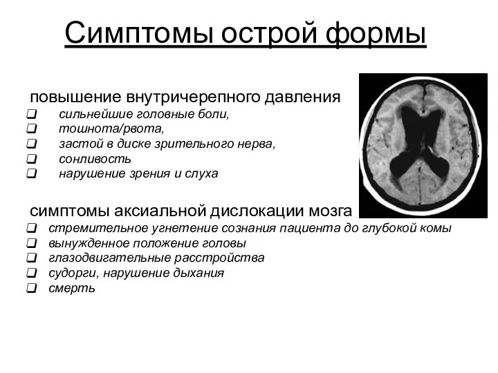 Симптомы острой формы повышение внутричерепного давления сильнейшие головные боли, тошнота/рвота, застой