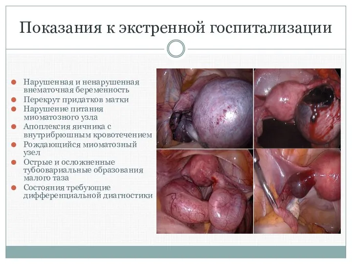 Показания к экстренной госпитализации Нарушенная и ненарушенная внематочная беременность Перекрут придатков