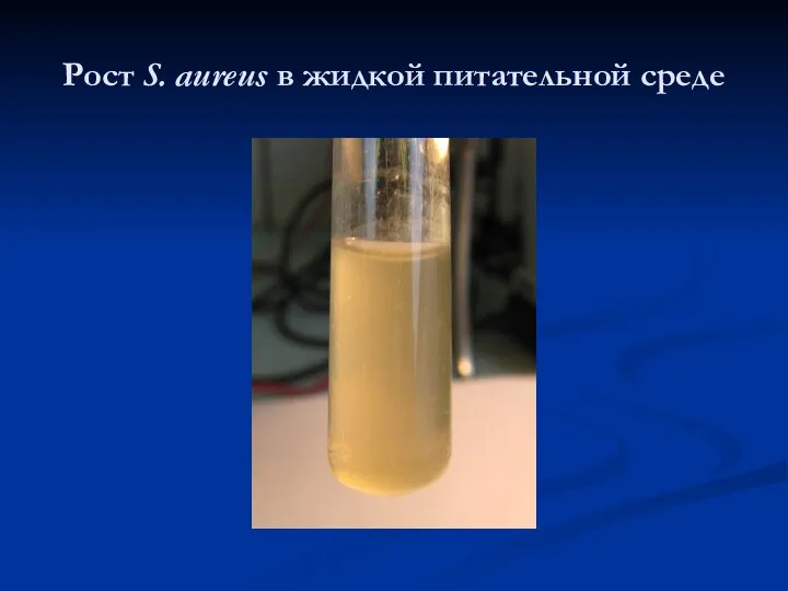 Рост S. aureus в жидкой питательной среде