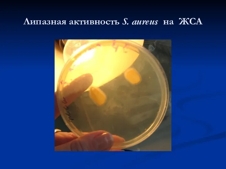 Липазная активность S. aureus на ЖСА