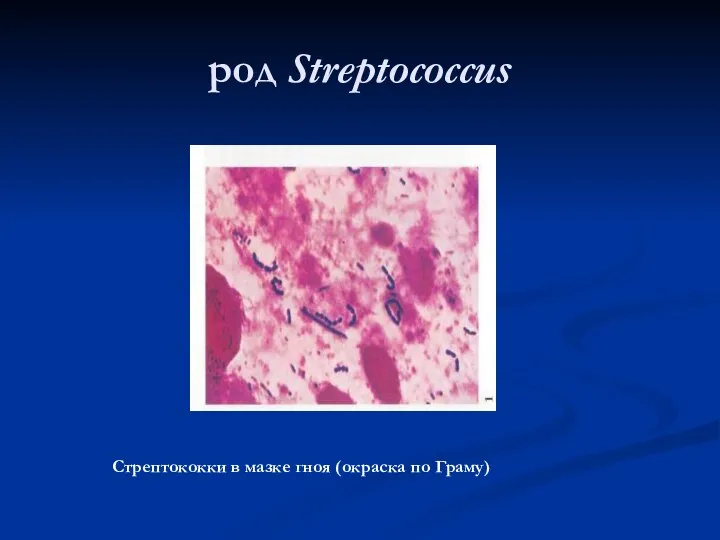 род Streptococcus Стрептококки в мазке гноя (окраска по Граму)