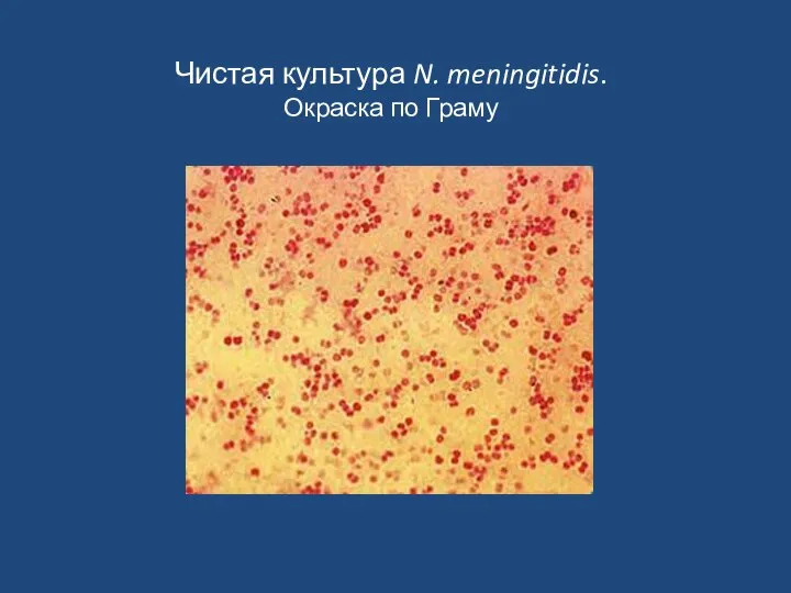 Чистая культура N. meningitidis. Окраска по Граму