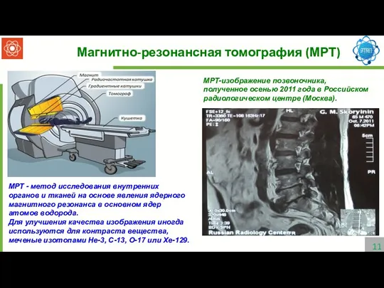 Магнитно-резонансная томография (МРТ) МРТ - метод исследования внутренних органов и тканей