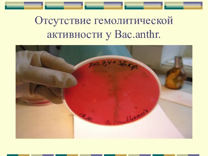 Отсутствие гемолитической активности у Bac.anthr.