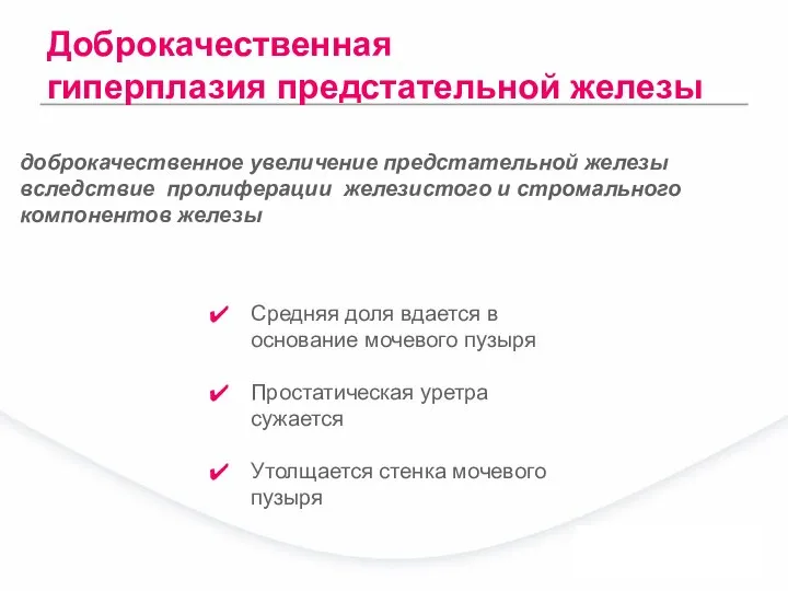 Средняя доля вдается в основание мочевого пузыря Простатическая уретра сужается Утолщается