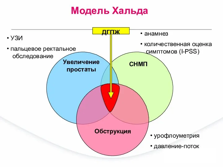 СНМП Обструкция Увеличение простаты Модель Хальда ДГПЖ анамнез количественная оценка симптомов