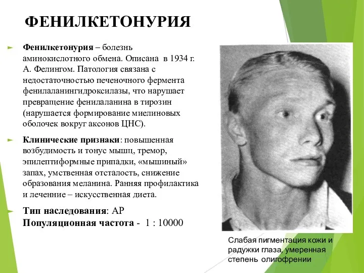 ФЕНИЛКЕТОНУРИЯ Фенилкетонурия – болезнь аминокислотного обмена. Описана в 1934 г. А.