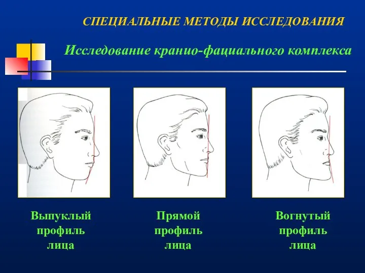 Исследование кранио-фациального комплекса Выпуклый профиль лица Прямой профиль лица Вогнутый профиль лица СПЕЦИАЛЬНЫЕ МЕТОДЫ ИССЛЕДОВАНИЯ